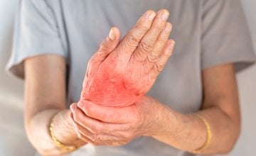 Ako živite s reumatoidnim artritisom, bol, ukočenost i oticanje šaka mogu pretvoriti i najjednostavnije kućanske zadatke u pravi izazov