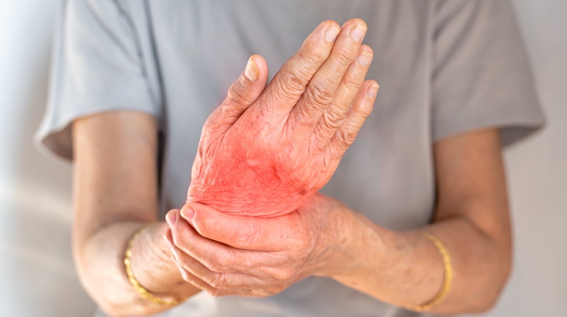 Ako živite s reumatoidnim artritisom, bol, ukočenost i oticanje šaka mogu pretvoriti i najjednostavnije kućanske zadatke u pravi izazov