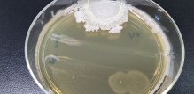 Bacillus cereus bakterija uzrokuje trovanje hranom