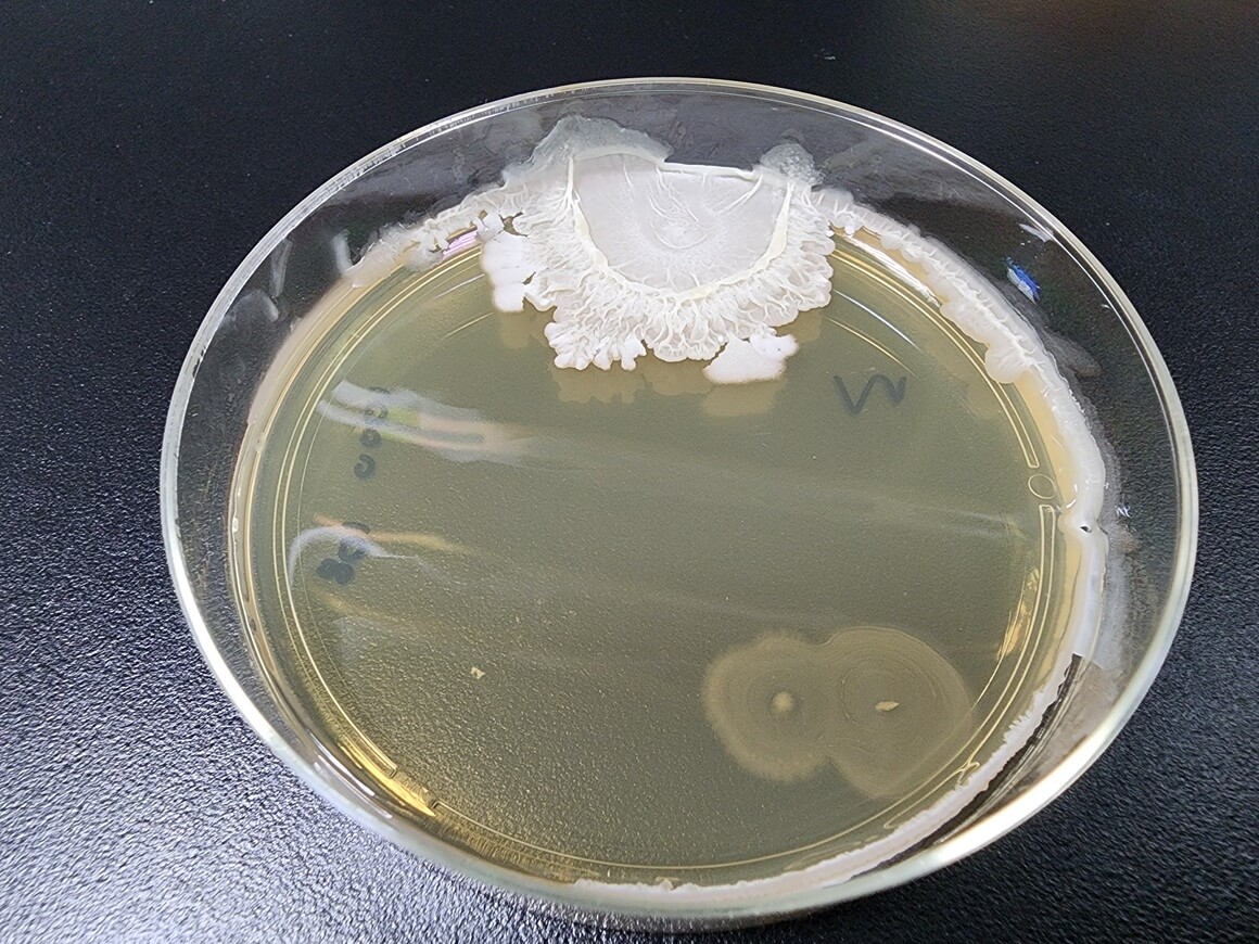 Bacillus cereus bakterija uzrokuje trovanje hranom