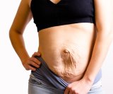 Dijastaza trbušnih mišića