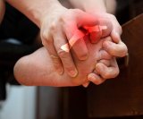 Giht je izuzetno bolna vrsta upalnog artritisa