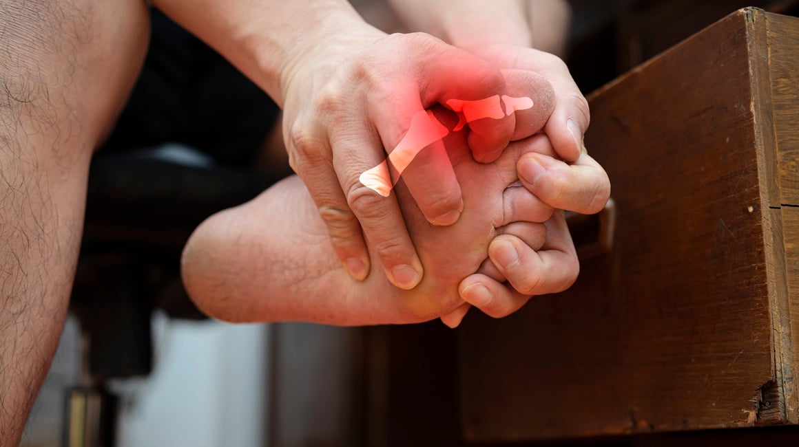 Giht je izuzetno bolna vrsta upalnog artritisa