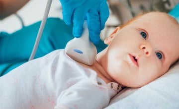 Kongenitalna hipotireoza