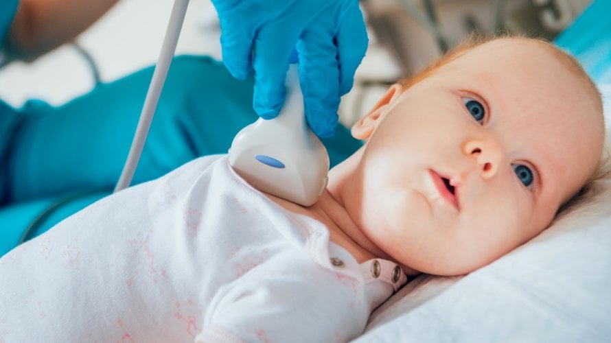 Kongenitalna hipotireoza