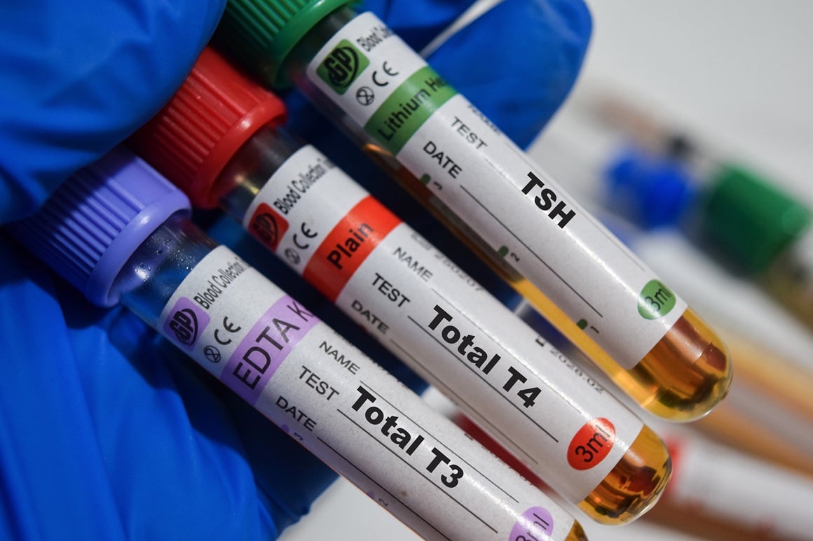 Kongenitalna hipotireoza - dijagnoza i liječenje