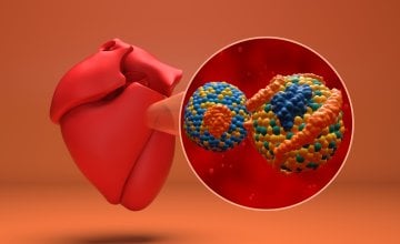 Lipoprotein (a) povišen