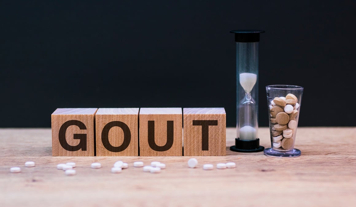 Tijekom napada gihta zglob postaje izrazito bolan, topao, crven i otečen