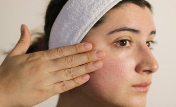 Zašto vam koža stalno gori Evo odgovora na 20 ključnih pitanja