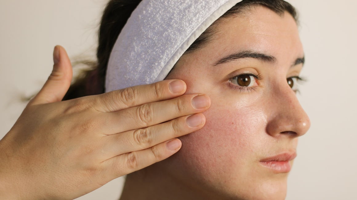 Zašto vam koža stalno gori Evo odgovora na 20 ključnih pitanja