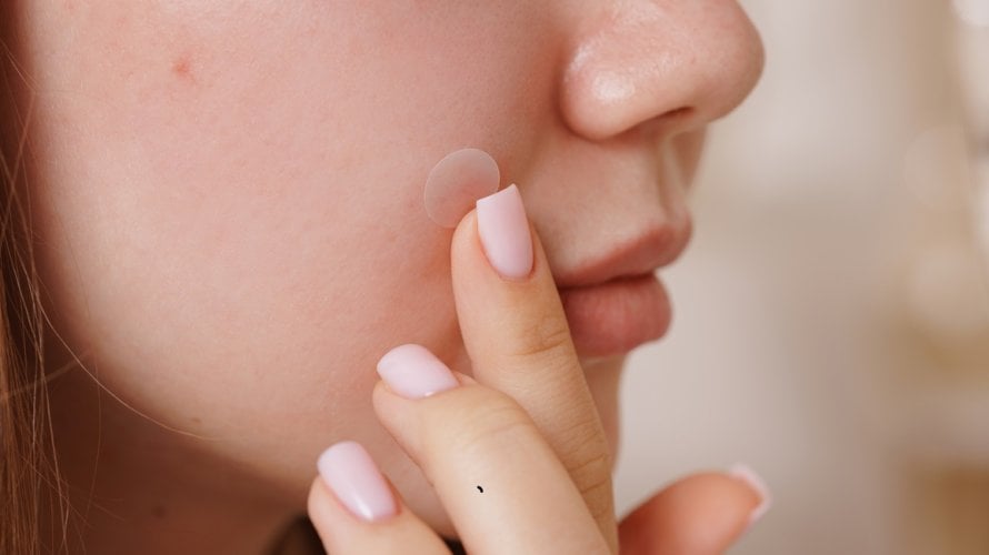 flasteri za prištiće nisu rješenje za sve