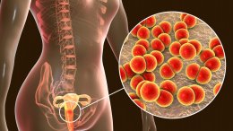 gonoreja svake godine pogađa više od 80 milijuna ljudi diljem svijeta