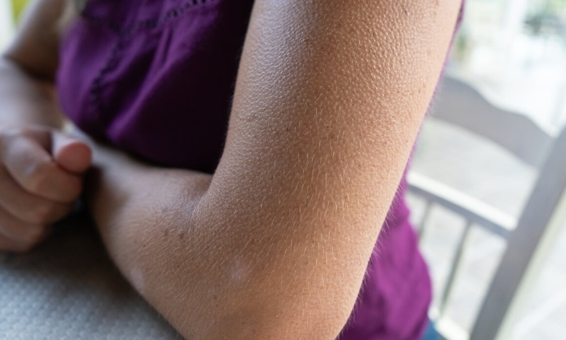 ježenje kože bez razloga