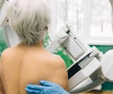 prosječna dob dijagnoze raka dojke iznosi 62 godine