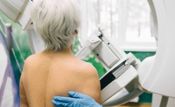 prosječna dob dijagnoze raka dojke iznosi 62 godine