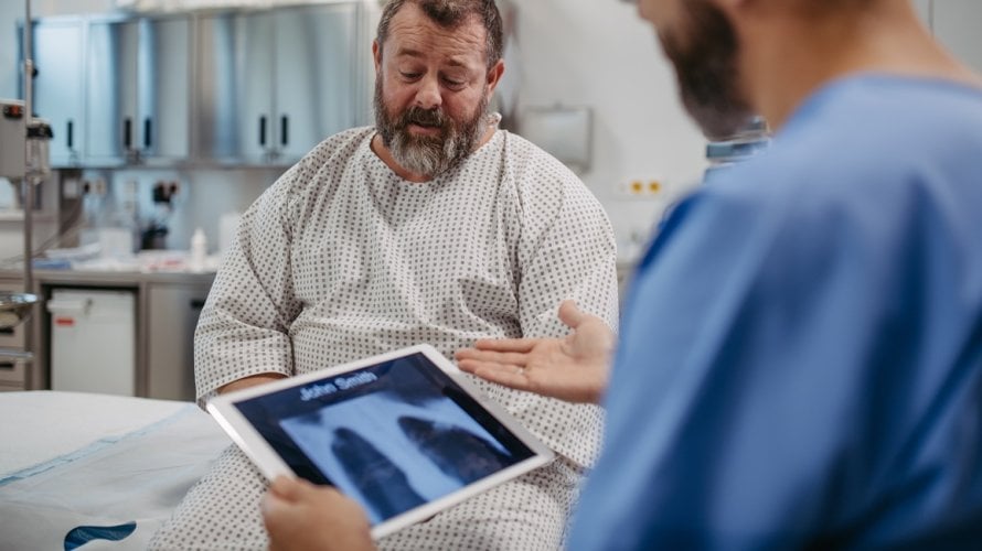 smrtnost od raka pluća kontinuirano se smanjuje