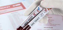 Ako mislite da ste mogli biti izloženi HIV-u, razgovarajte sa svojim liječnikom i testirajte se