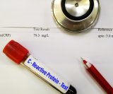 CRP je marker upale u krvi