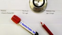 CRP je marker upale u krvi