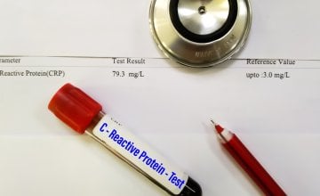 CRP je marker upale u krvi