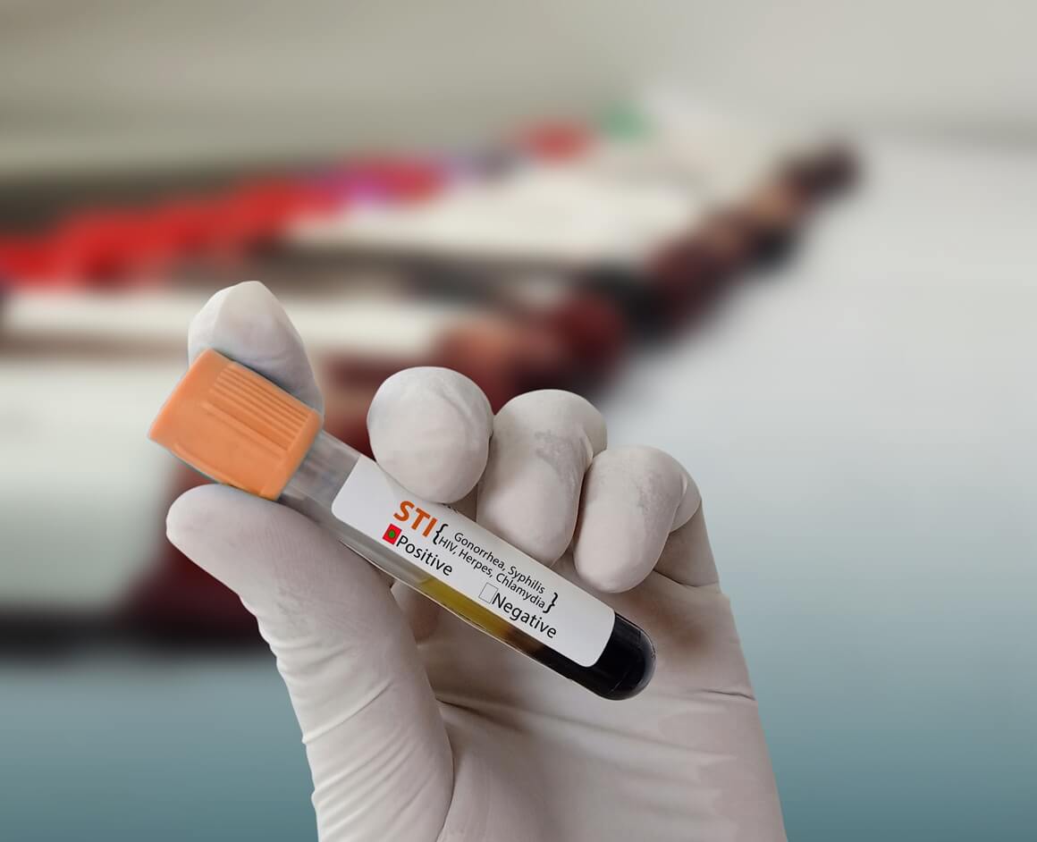 Kada zatražite testiranje na sve, liječnik će vas obično testirati samo na određene genitalne infekcije