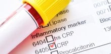 Kako sniziti CRP prirodnim putem