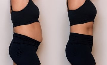 Kalorijski deficit omogućuje oslobađanje masnoća iz masnih stanica, dok tjelovježba taj proces dodatno ubrzava