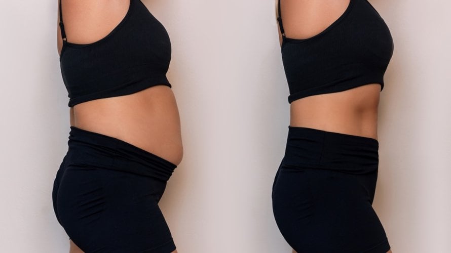 Kalorijski deficit omogućuje oslobađanje masnoća iz masnih stanica, dok tjelovježba taj proces dodatno ubrzava