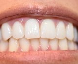 Koliko odrasli čovjek ima zubi