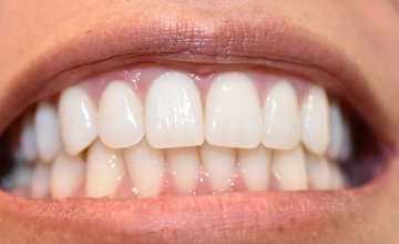 Koliko odrasli čovjek ima zubi