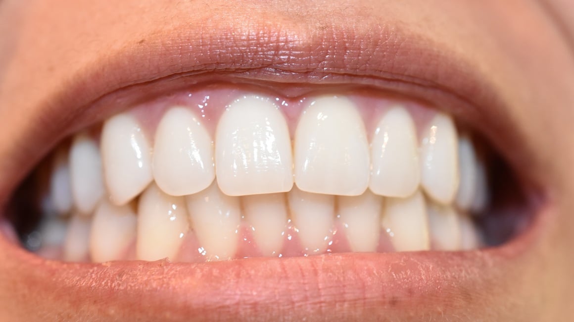 Koliko odrasli čovjek ima zubi