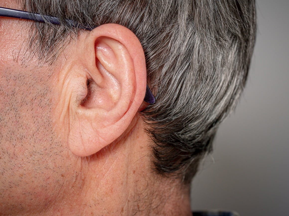 Nažalost, utjecaj gravitacije i prirodnog starenja teško je u potpunosti spriječiti