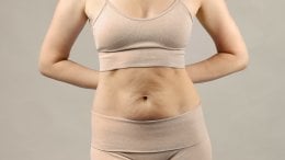 Obješena koža nakon mršavljenja