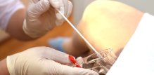 Papa test služi za otkrivanje promjena na vratu maternice koje mogu dovesti do raka te za otkrivanje HPV-a