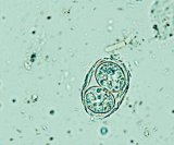 Parazitom Toxoplasma gondii je zaražena gotovo trećina svjetske populacije