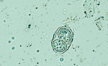 Parazitom Toxoplasma gondii je zaražena gotovo trećina svjetske populacije