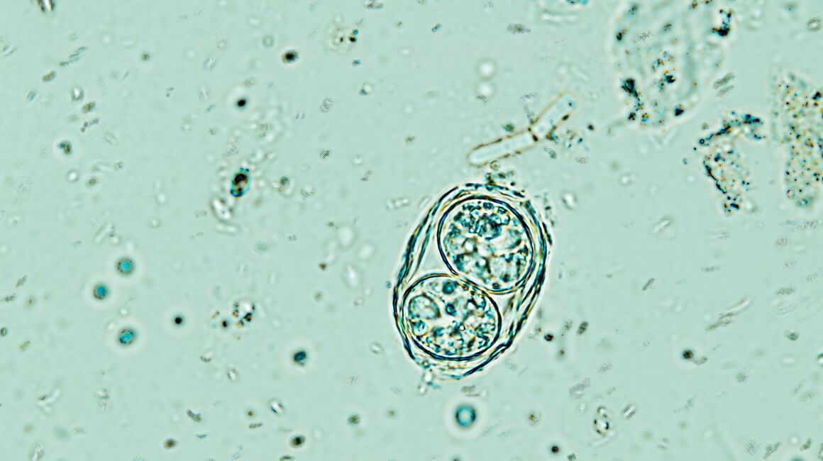 Parazitom Toxoplasma gondii je zaražena gotovo trećina svjetske populacije