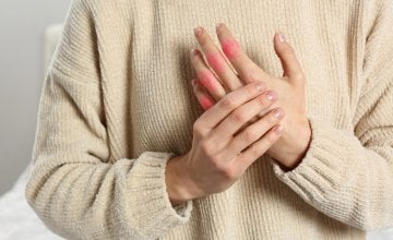 Rezultati studije su pokazali da su osobe koje su primale abatacept tijekom 12 mjeseci razvile reumatoidni artritis znatno kasnije