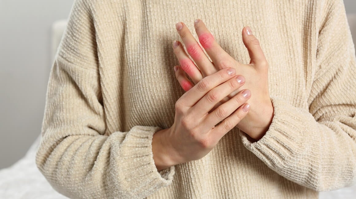 Rezultati studije su pokazali da su osobe koje su primale abatacept tijekom 12 mjeseci razvile reumatoidni artritis znatno kasnije