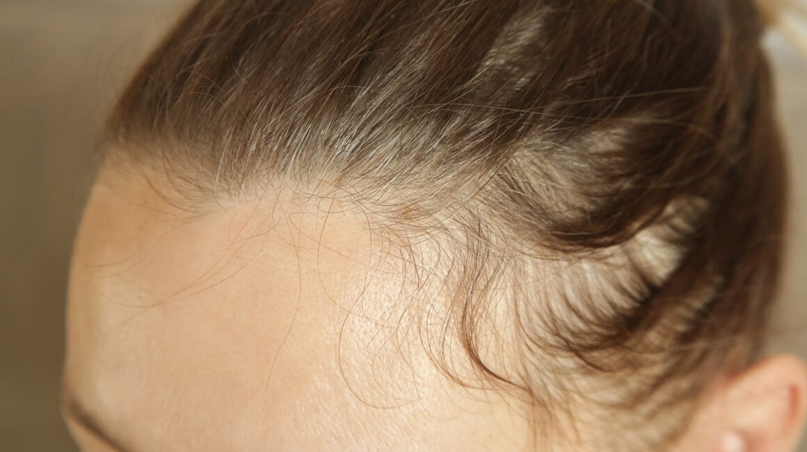 Stručnjaci ističu da je kod ispadanja kose ključno unositi nutrijente koji služe kao građevni materijal za kosu i pomažu u njezinoj zaštiti