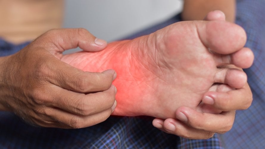 Svrbež ruku i stopala