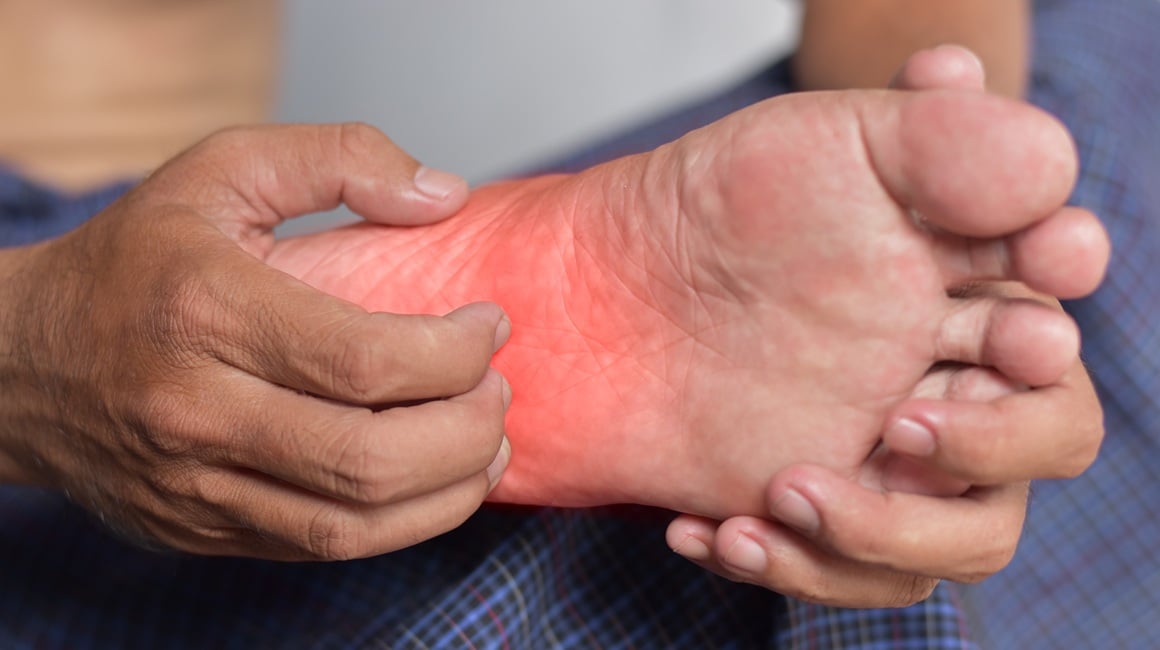 Svrbež ruku i stopala