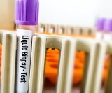 Tekuća biopsija