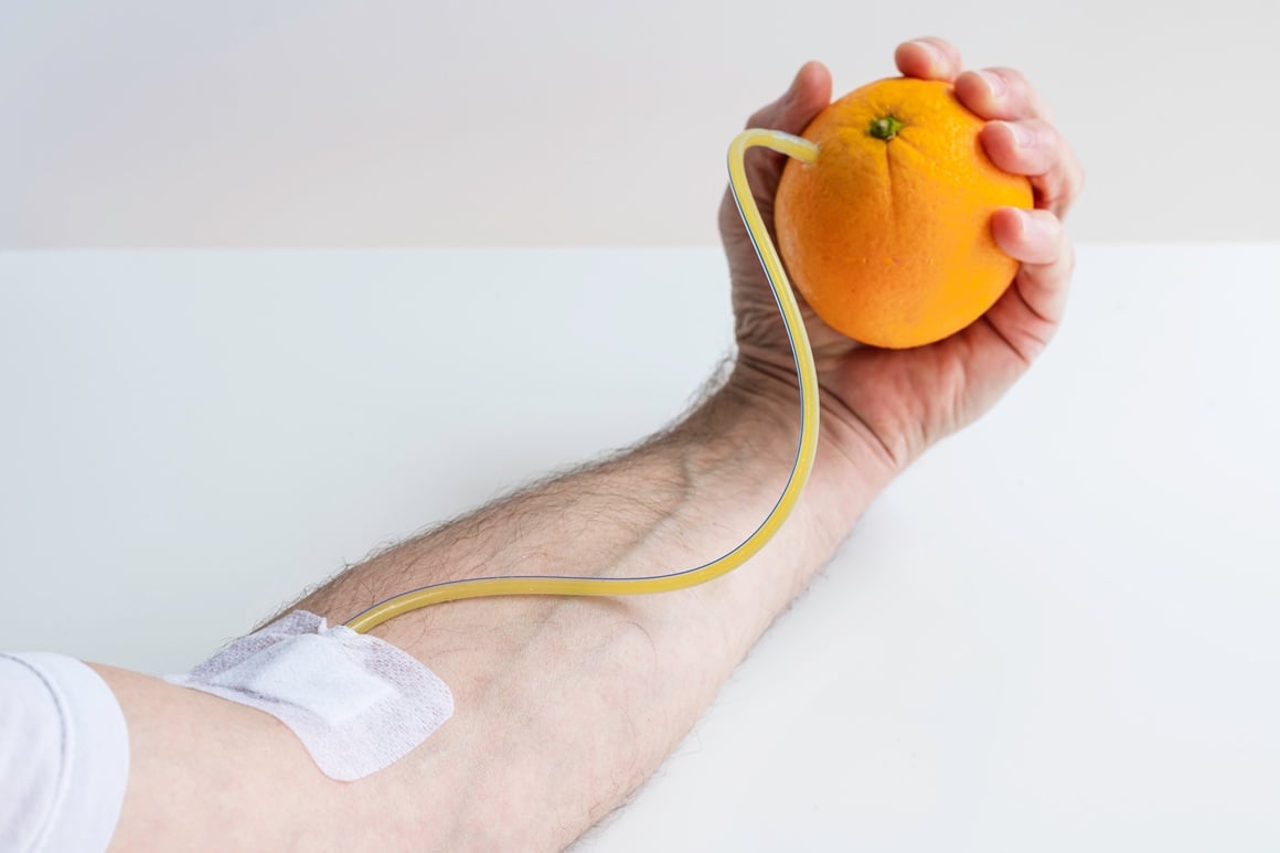 Teški nedostatak vitamina C uzrokuje bolest poznatu kao skorbut