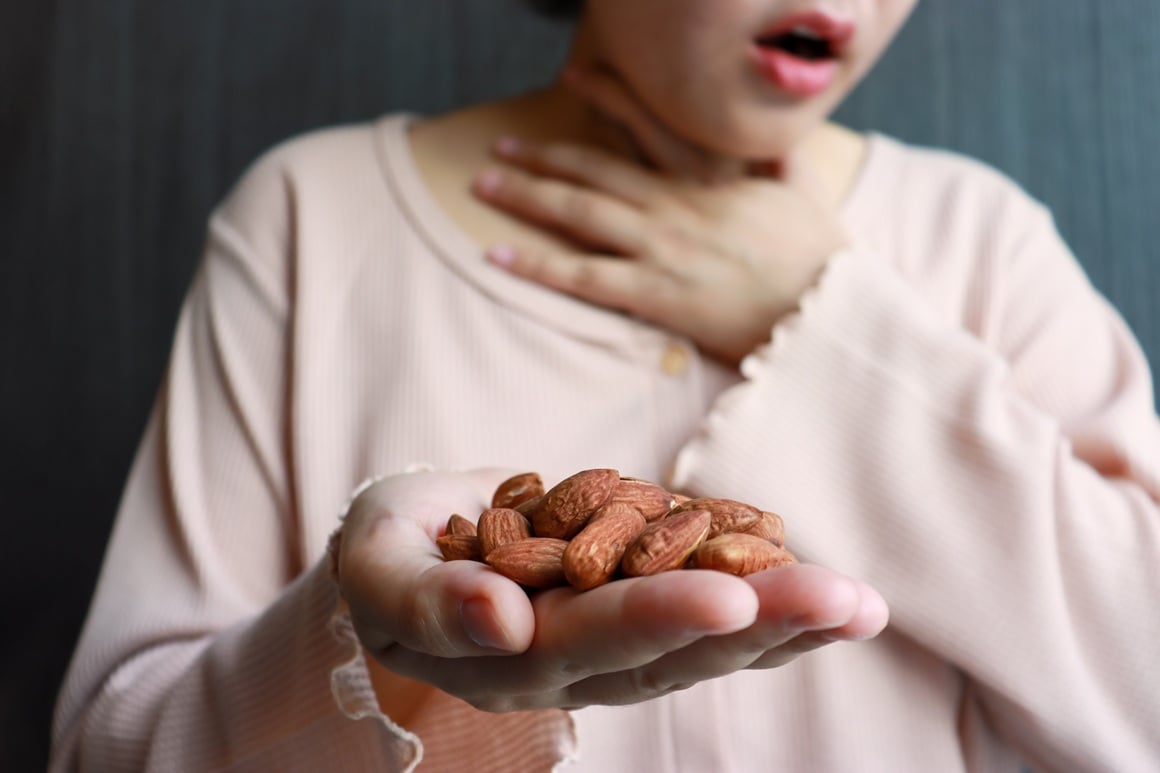 genetika sama po sebi ne može objasniti porast alergija na hranu kod djece