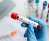 jednostavniji način testiranja na HPV