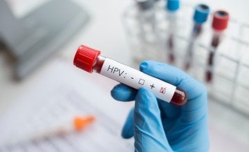 jednostavniji način testiranja na HPV