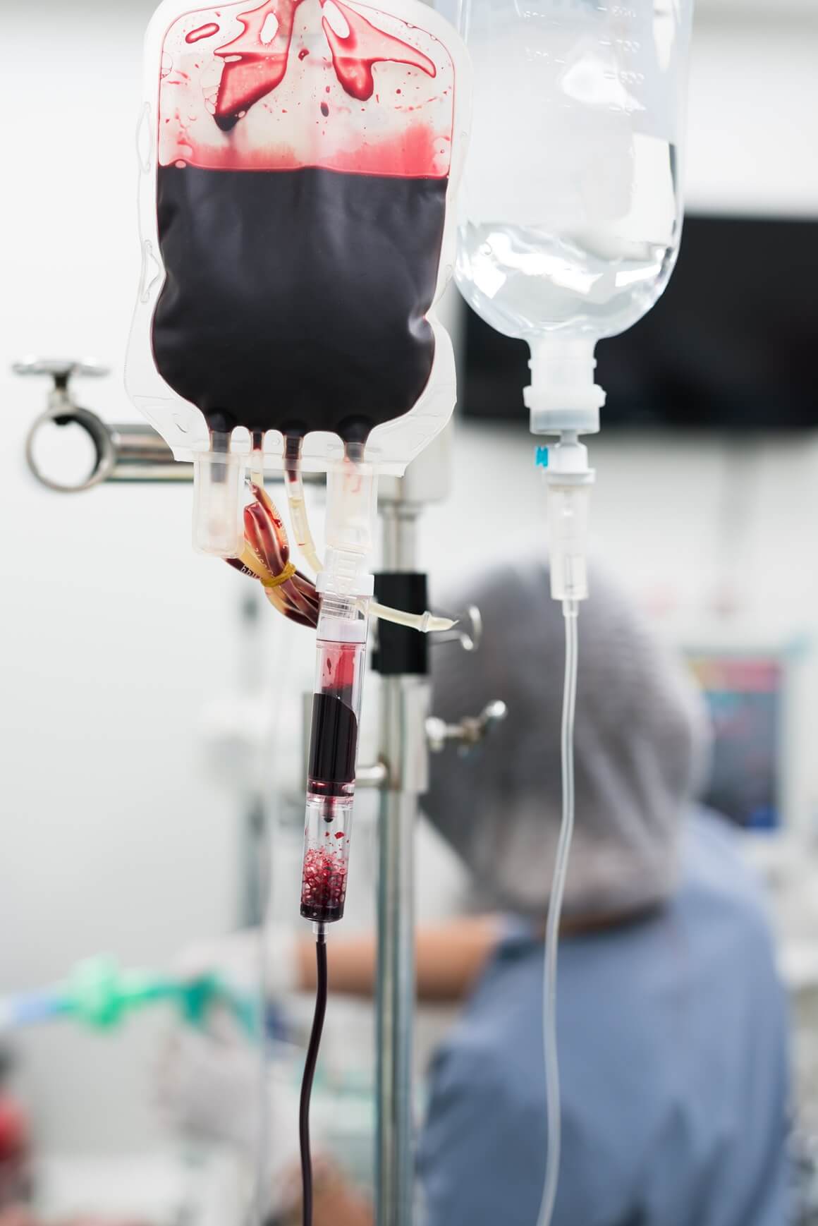 0-negativna krv ključna je kada su potrebne hitne transfuzije prije nego što se utvrdi krvna grupa