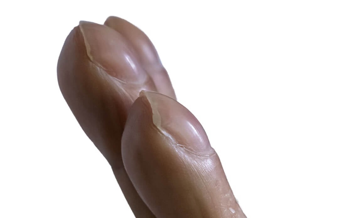 Batićasti prsti - slike