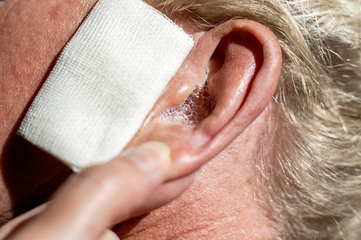 Kapi za vraćanje sluha